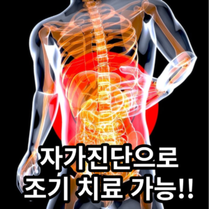 대장암 자가진단